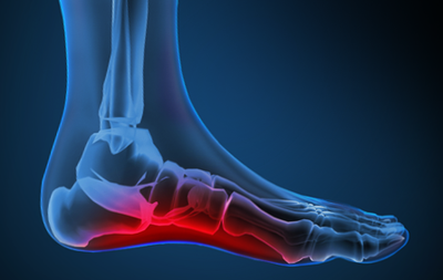 Telltale Signs of Foot Pain and What to Do About It